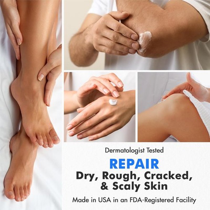 Ebanel Professional Callus Remover Set - Urea 40% & Salicylic Acid 2% for Soft Feet | Exfoliating Gel & Cream