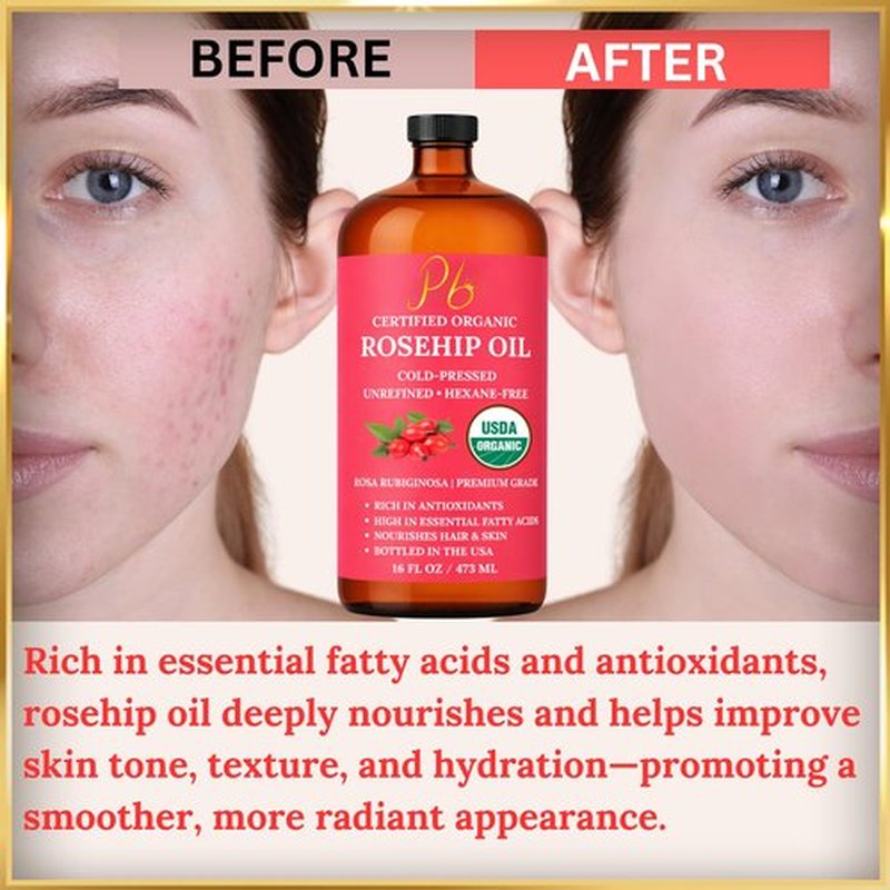 Pomberries Rosehip Seed Oil for Face, Skin & Hair – 100% Pure, Cold-Pressed & Unrefined USDA Organic Rosehip Oil – Helps Reduce the Appearance of Fine Lines & Wrinkles – 16 fl oz Glass Bottle