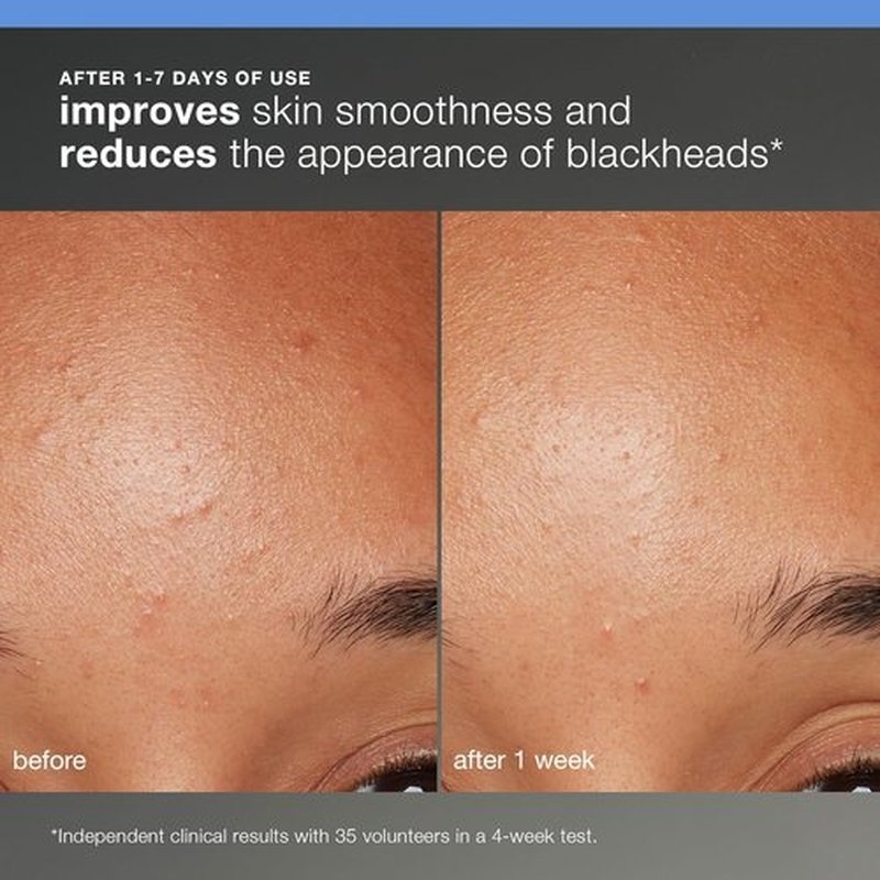Dermalogica Healthy Skin Kit - Precleanse, Face Wash, Exfoliator & Moisturizer for Glowing Skin