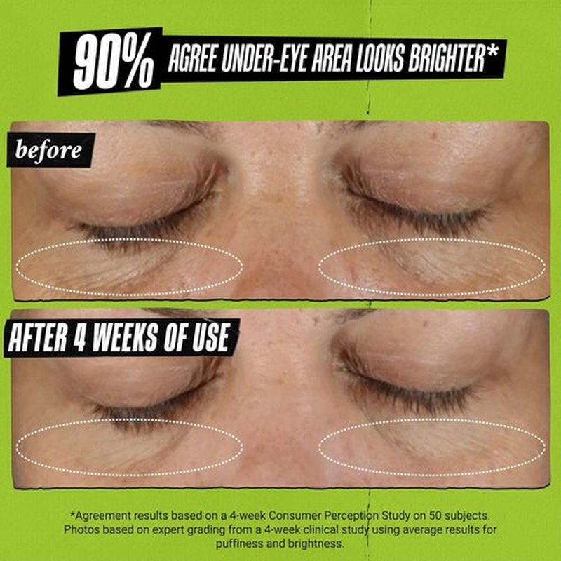 Kiehl's Avocado Eye Treatment - Under Eye Cream for Puffiness & Dark Circles | Caffeine-Infused, 99% Natural
