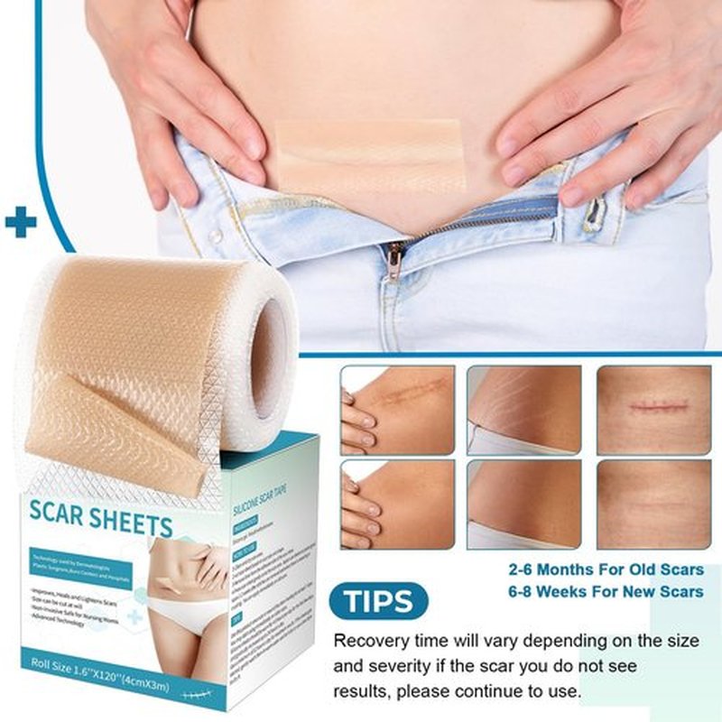 Silicone Scar Sheets, Silicone Scar Tape(1.6”x 120” Roll-3M), Silicone Scar Strips, Professional Scar Removal Sheets for Surgical Scars, Keloid, C-Section, Burn et