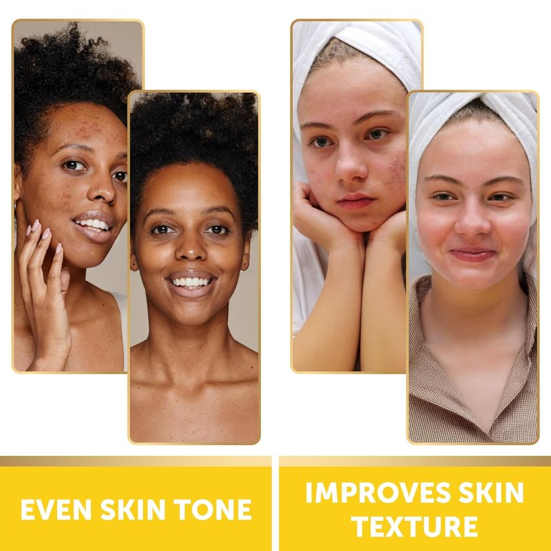 VALITIC Turmeric Kojic Acid Cleansing Pads - Exfoliating Dark Spot Remover with Vitamin C & Retinol - 60 Count