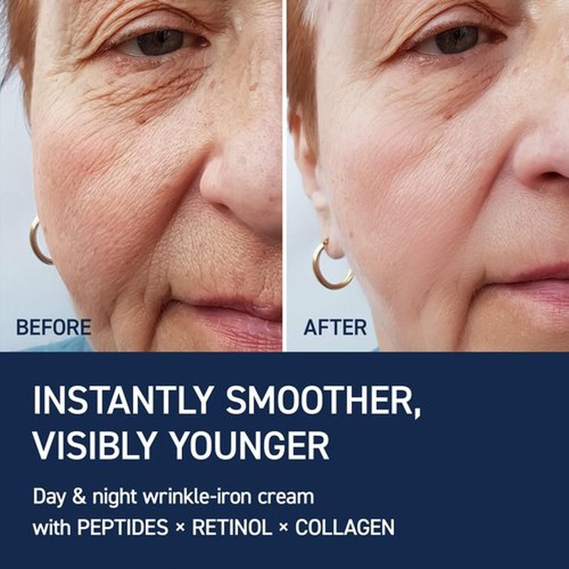 IVOSKIN Collagen Neck Cream with Retinol & Multi Peptides, Firming & Tightening Moisturizer for Fine Lines, Décolleté, Sagging Skin, Korean Skincare, 1.69 fl oz (50 ml)