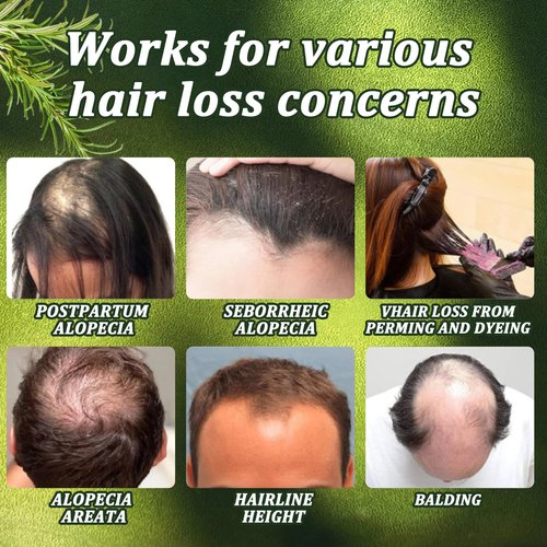 Chambelza Organic Rosemary Hair Growth Shampoo for Men and Women -Natural Thickening and Strengthening Formula with Biotin Hydrolyzed Keratin -Designed for Thinning Hair & Hair Loss 10.15 fl.oz-2 Pack