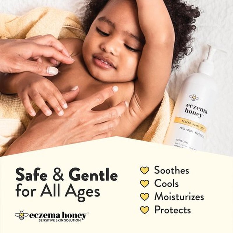 Regine Switzerland Eczema Honey Oatmeal Body Lotion - Natural Relief for Dry Skin (16 Oz)