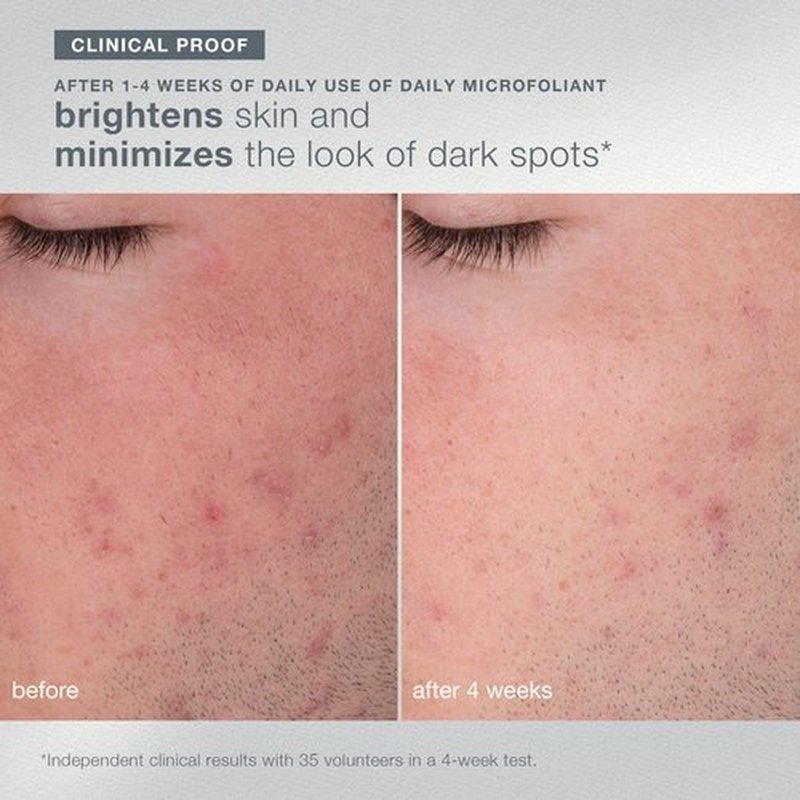 Dermalogica Light Up the Room – Facial Cleansing Skin Care Set, Includes Face Exfoliants, Cleanser, Mask, and Fan Brush