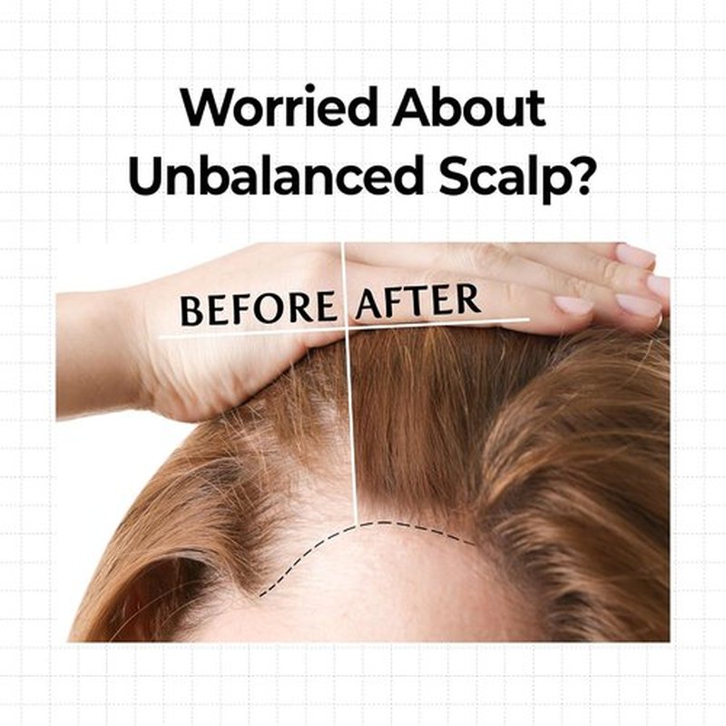 KUNDAL Hair Loss Serum - Caffeine Scalp Tonic & Shampoo | White Musk Scented Treatment