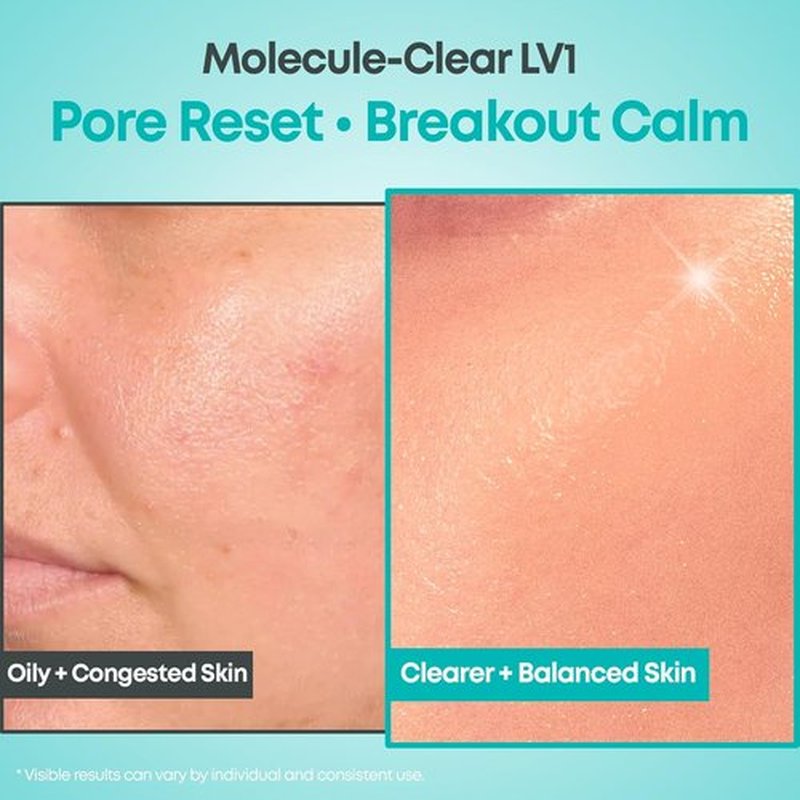 NINELESS Salicylic Acid Serum - Deep Pore Exfoliating BHA for Oily Acne-Prone Skin | Hydrating & Soothing, 1.01 fl oz