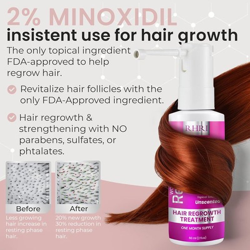 Minoxidil 2% Hair Regrowth Spray for Women - Clinically Proven Thicker & Fuller Solution | 60 ml