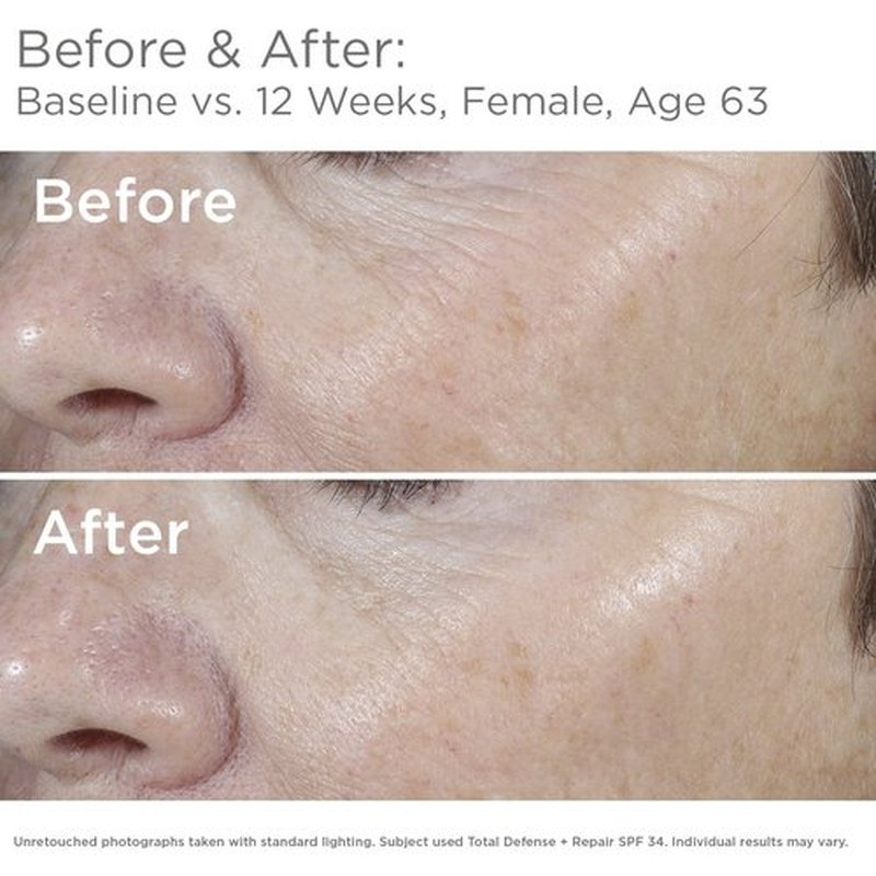 SkinMedica Total Defense + Repair SPF 34 - Broad Spectrum Sunscreen for Face Protection