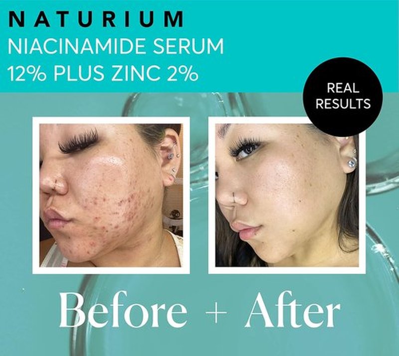 Naturium Niacinamide Face Serum 12% - Anti-Aging Pore Minimizer & Dark Spot Corrector | 1 oz Vegan Formula