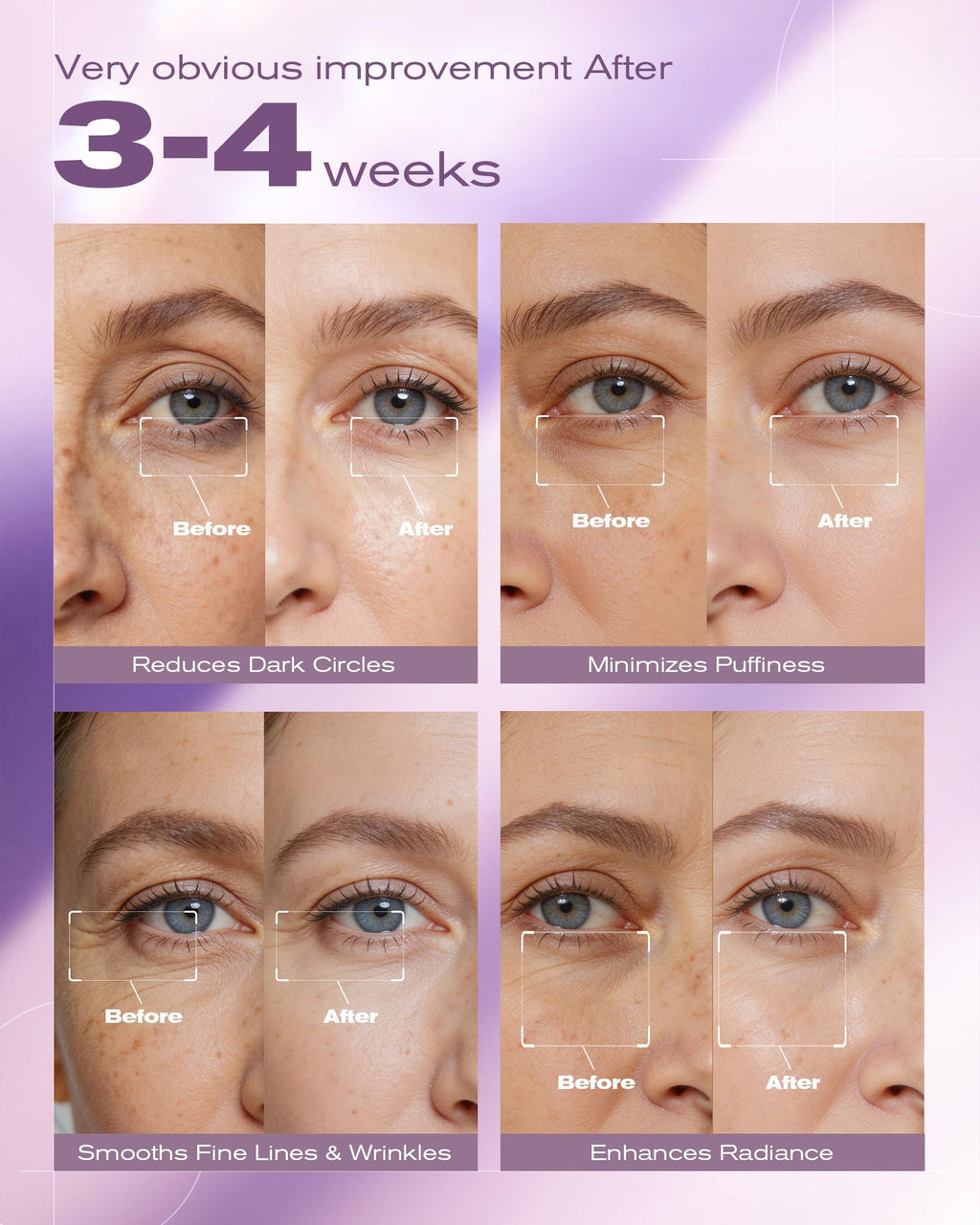 5% Caffeine Eye Serum & Under Eye Cream for Dark Circles and Puffiness Eye Care Eye Roller Serum with 360° Massage Ball Eye Treatment Serum Under Eye Roller Cream for Women Reduce Wrinkles Fine Lines