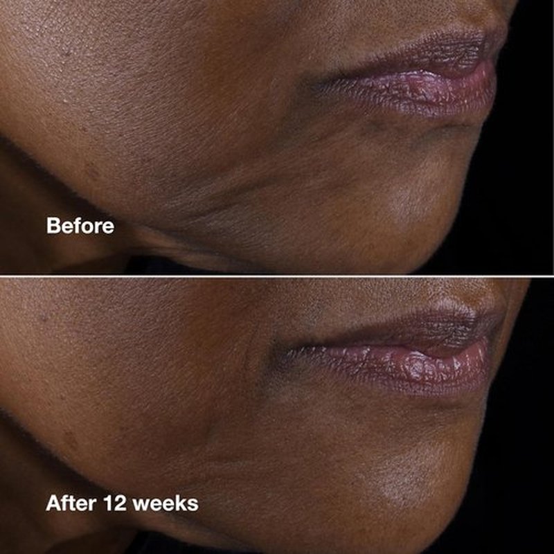 Clinique Smart Clinical Repair Anti-Aging Face & Neck Cream - Hydrating with Peptides & Hyaluronic Acid for All Skin Types
