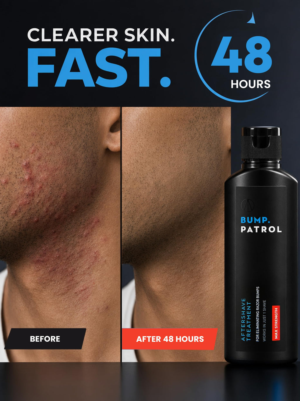 Bump Patrol Maximum Strength Aftershave Treatment Serum – Razor Bump Stopper and Ingrown Hair Treatment for Men and Women, Fast Acting Salicylic Acid for Razor Burn & Shaving Irritation - 2 oz Pack 4