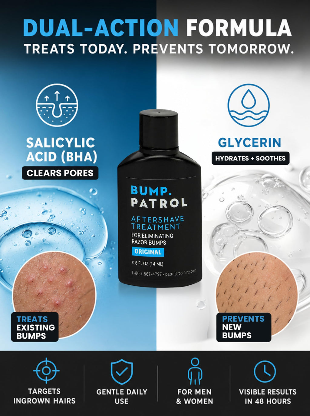 Bump Patrol Original Formula Aftershave Treatment Serum – Razor Bump Stopper and Ingrown Hair Treatment for Men and Women with Salicylic Acid for Razor Burn & Shaving Irritation