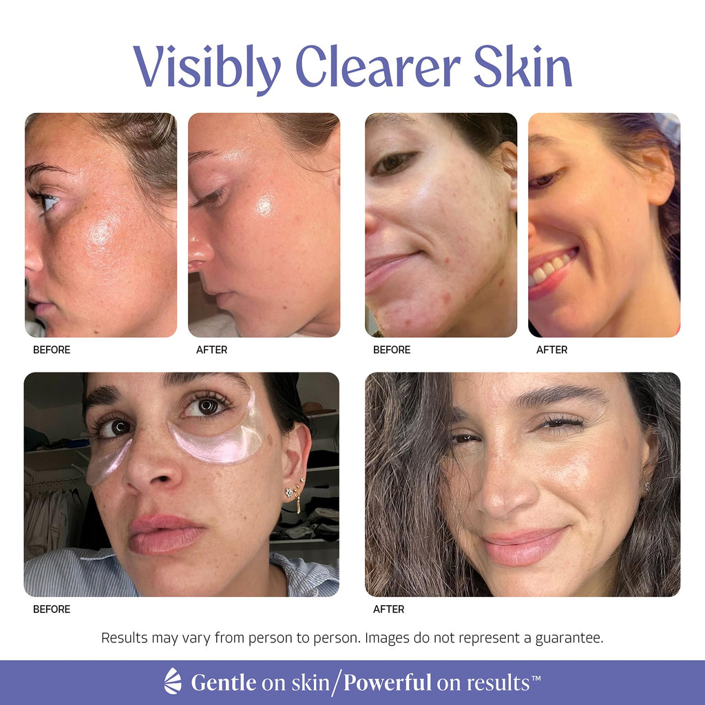 Almond Clear 2-in-1 Hydrating Gel | Lightweight Mandelic Acid Moisturizer for Oily, Blemish-Prone Skin | Aloe Vera, Squalane, Hyaluronic Acid, Mandelic Acid, Bakuchiol | 4 oz