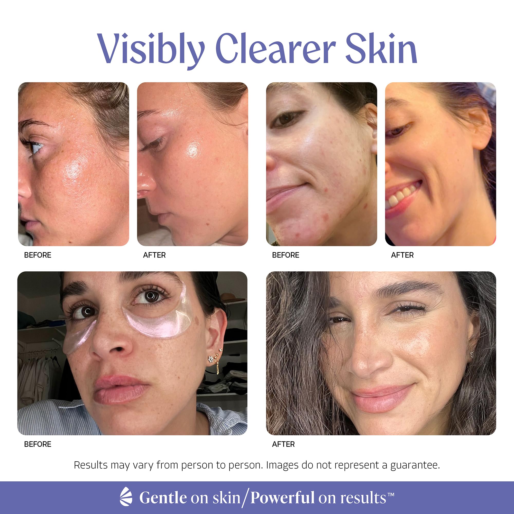 Almond Clear 2-in-1 Hydrating Gel | Lightweight Mandelic Acid Moisturizer for Oily, Blemish-Prone Skin | Aloe Vera, Squalane, Hyaluronic Acid, Mandelic Acid, Bakuchiol | 4 oz