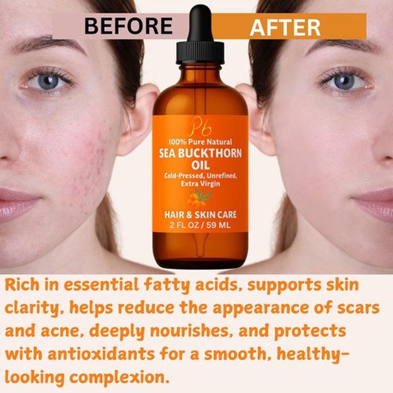Pomberries Sea Buckthorn Oil – 100% Pure Cold-Pressed from Fruit & Seed – Sea Buckthorn Seed Oil for Face, Hair, Skin & Nails – Supports Radiant, Youthful-Looking Skin – Amber Glass Bottle 2 fl oz