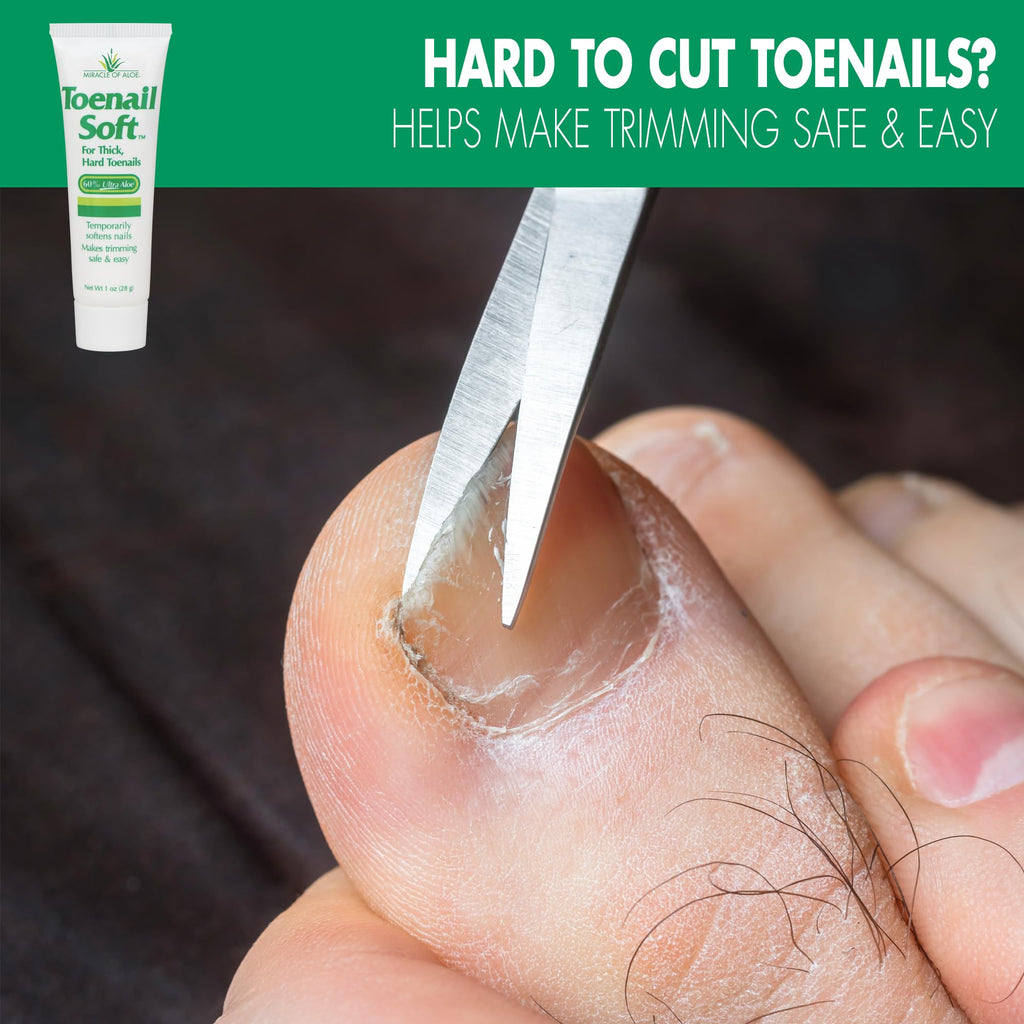 Toenail Softener for Thick Hard Toenails - Safe for Seniors & All Ages - Fast-Acting Toenail Softening Cream - Non Greasy Nail Cream Formulated with Natural Aloe Vera (1 Ounce Tube (Pack of 2))