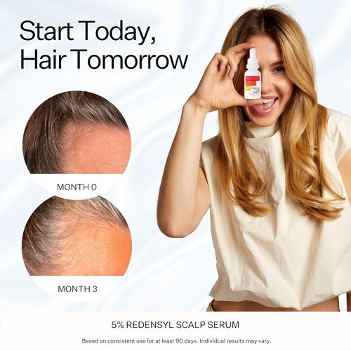**Scalp Delivery 5% Redensyl Hair Growth Serum - Vegan Follicle Activator for Thinning Hair & Regrowth**