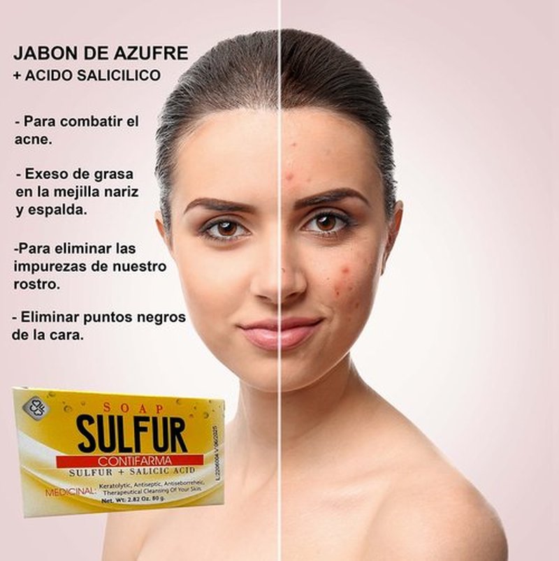 Contifarma AZUFRE + ACIDO SALICILICO, jabon, tratamiento para el acne, sulfur soap, for acne, with salicylic acid, Pack of 1