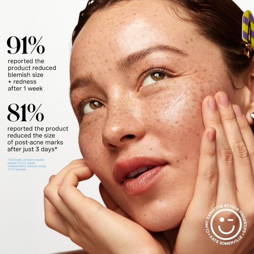 Kate Somerville EradiKate Acne Mark Fading Gel - Salicylic Acid Treatment for Clear Skin | 1 Fl Oz
