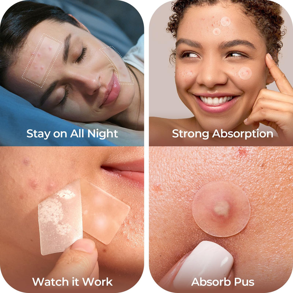 LitBear Large Pimple Patches, 5 Sizes 212 Counts Big Acne Patches for Face, Forehead, Body and Back, Hydrocolloid Bandages for Zits, Blemishes and Large Breakouts, Hydrocolloid Patch Pimple Stickers