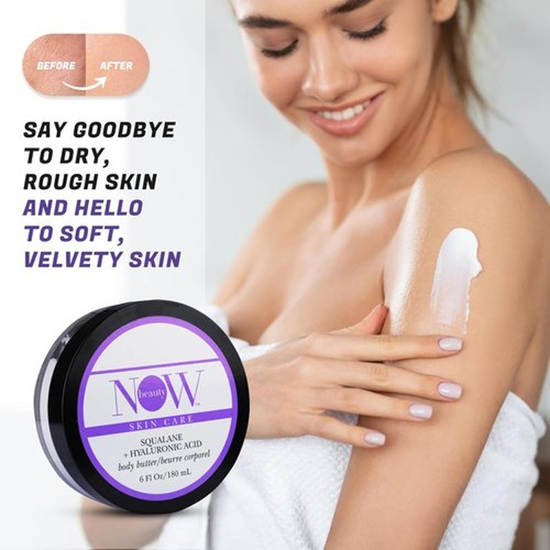 NOW Beauty Squalane Body Butter - Hydrating Lotion with Coconut Oil & Shea Butter - 6 oz Moisturizing Cream for Dry Skin