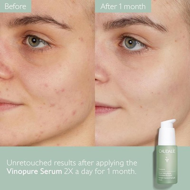 Caudalie Vinopure Pore Minimizing Serum - Natural Salicylic Acid & Niacinamide, 30 mL