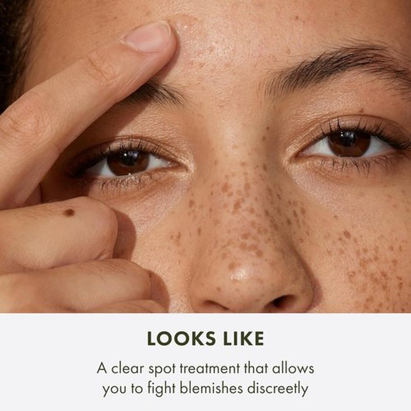 Origins Super Spot Treatment for Acne - Treats & Prevents Blemishes with Salicylic Acid, 0.3 Fl Oz