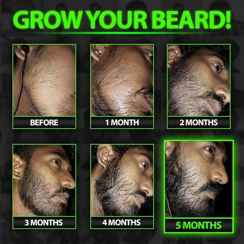 Skiennix Beard Growth Serum - Maximum XXL Oil for Men - Thickens & Fills Patches - Facial Hair & Scalp Treatment
