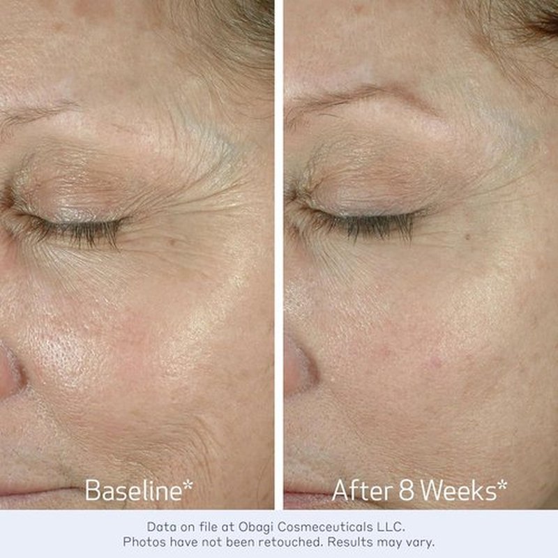 Obagi ELASTIderm Eye Cream - Lightweight Formula to Reduce Fine Lines & Wrinkles | Clinically Proven