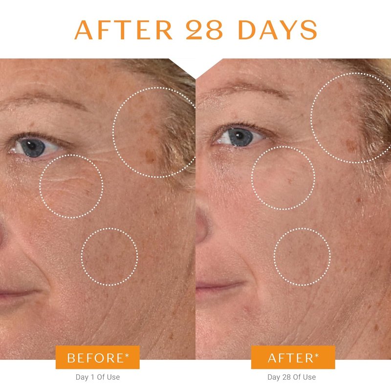 Yon-Ka 20% Vitamin C Serum - Concentrated Anti-Aging Face Treatment for Even Tone & Firm Skin