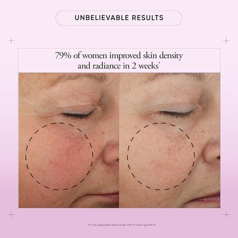 Philosophy Ultimate Miracle Worker Face Moisturizer Cream | SPF 30 with Encapsulated Retinol - 2 Fl Oz for Youthful, Radiant Skin