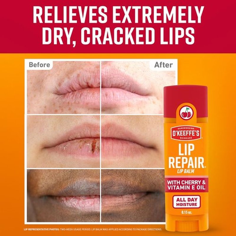 O'Keeffe's Lip Repair Lip Balm - Cherry & Vitamin E Oil - 3 Pack for Extremely Dry, Cracked Lips