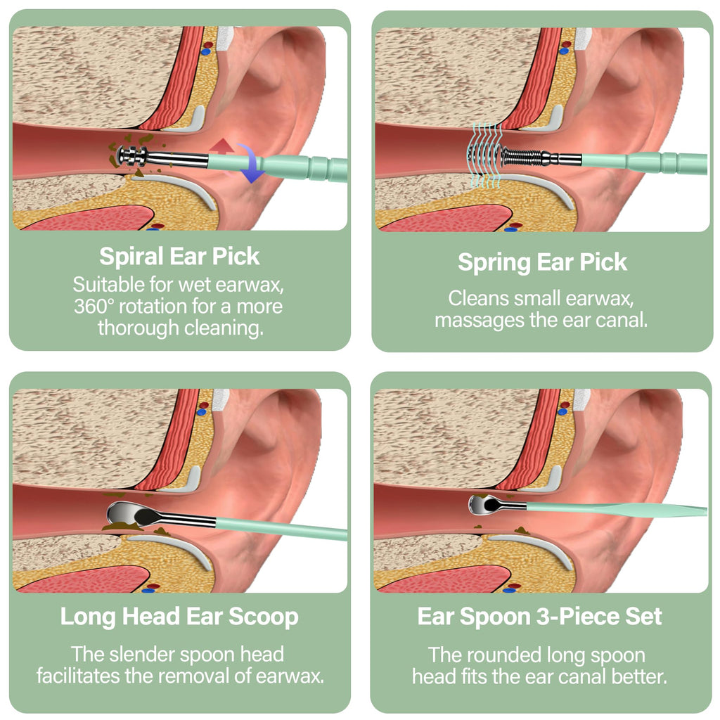 15 Pack Ear Wax Removal Tool Kit with Light - LED Ear Cleaning Kit, Ear Wax Removal for Kids and Adults, Ear Cleaning Tool, Ear Picker Spoon & Ear Tweezers & Spiral Spring Ear Spoon Green