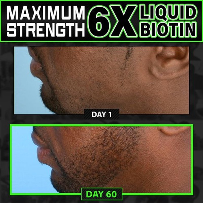 Beard Growth Kit - Skiennix Biotin Beard Balm & Conditioner + 6X Liquid Biotin for Thicker Hair