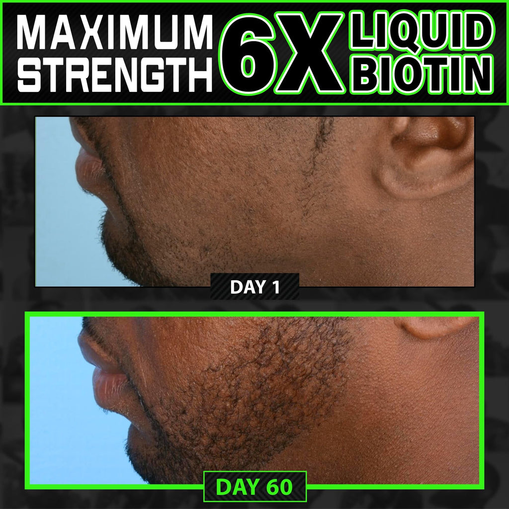 Beard Growth Kit w/ 2X Thickening Biotin Beard Balm Care & Beard Conditioner + 6X Liquid Biotin with Collagen Peptides for Beard & Hair Growth