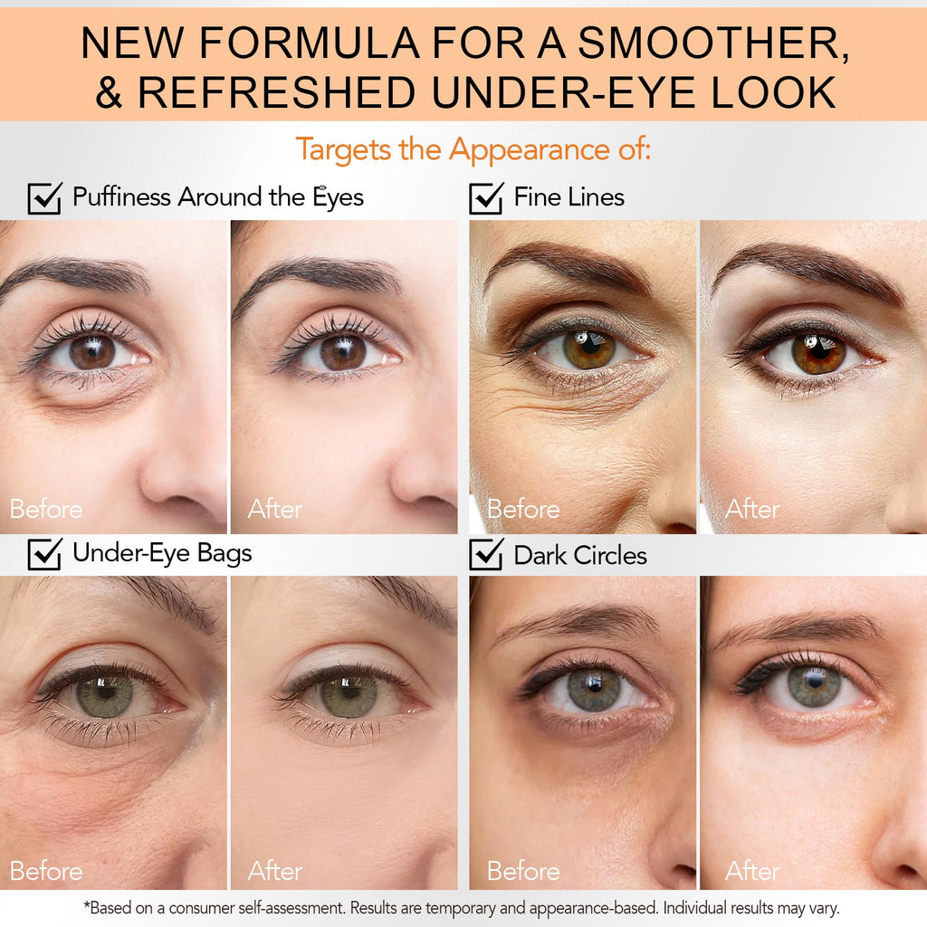 ABOUME Under Eye Cream, Eye Firming Cream With Peptide Complex & Hydrating Formula to Reduce Under-Eye Puffiness, Fine Lines & Crow‘s Feet, Anti Aging Eye Cream for Women and Men (1PCS)