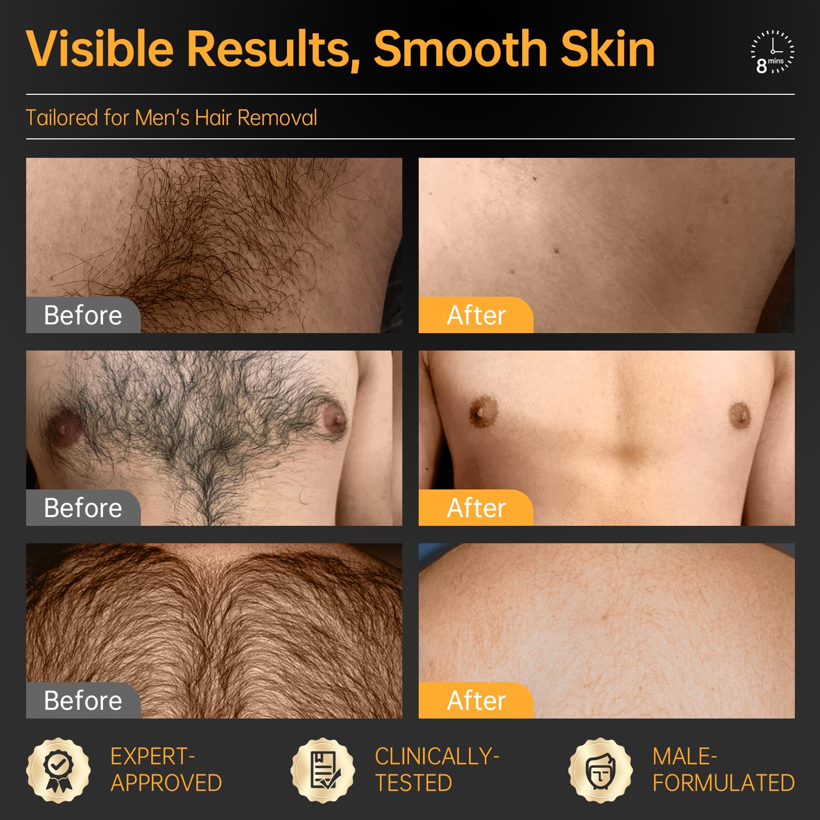 CKM Hair Removal Cream for Men, Depilatory Cream for Unwanted Male Hair, Painless Hair Removal Gel Suitable for All Skin Types, Made for Men, 3.38 FL OZ w/Spatula