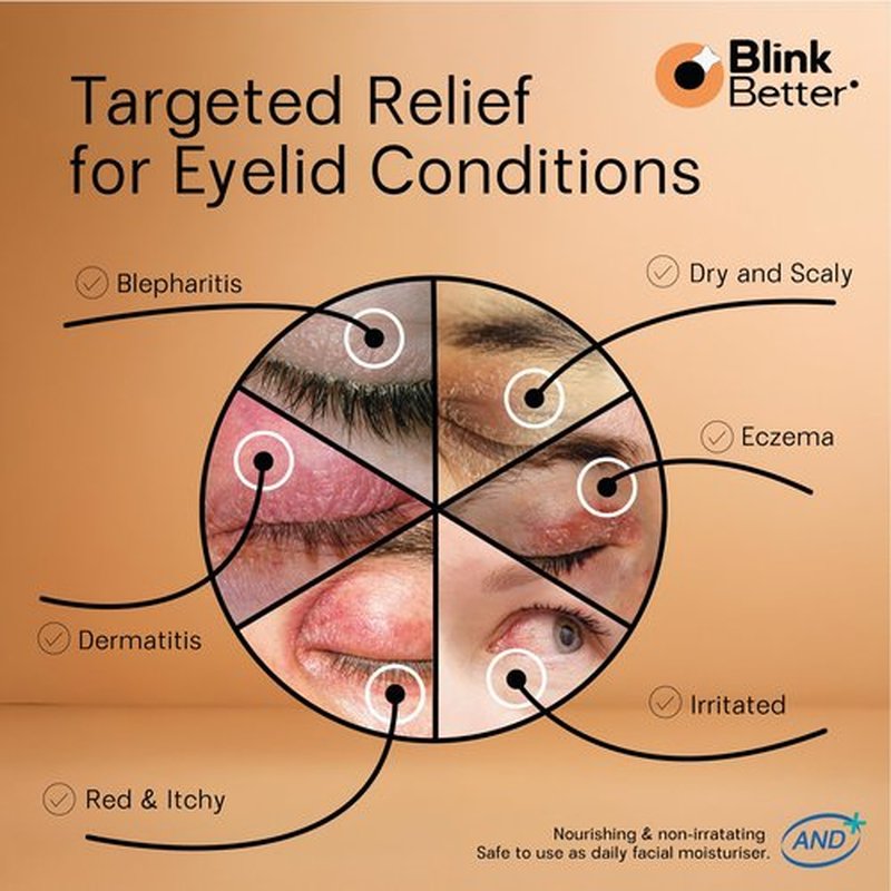BlinkBetter BetterLids Restore Eyelid Cream – Barrier Support to Hydrate, Soothe & Moisturise Dry, Itchy, Red & Sensitive Eyelids – Lightweight Daily Formula with 3% Oat & Ceramides, 1 fl oz