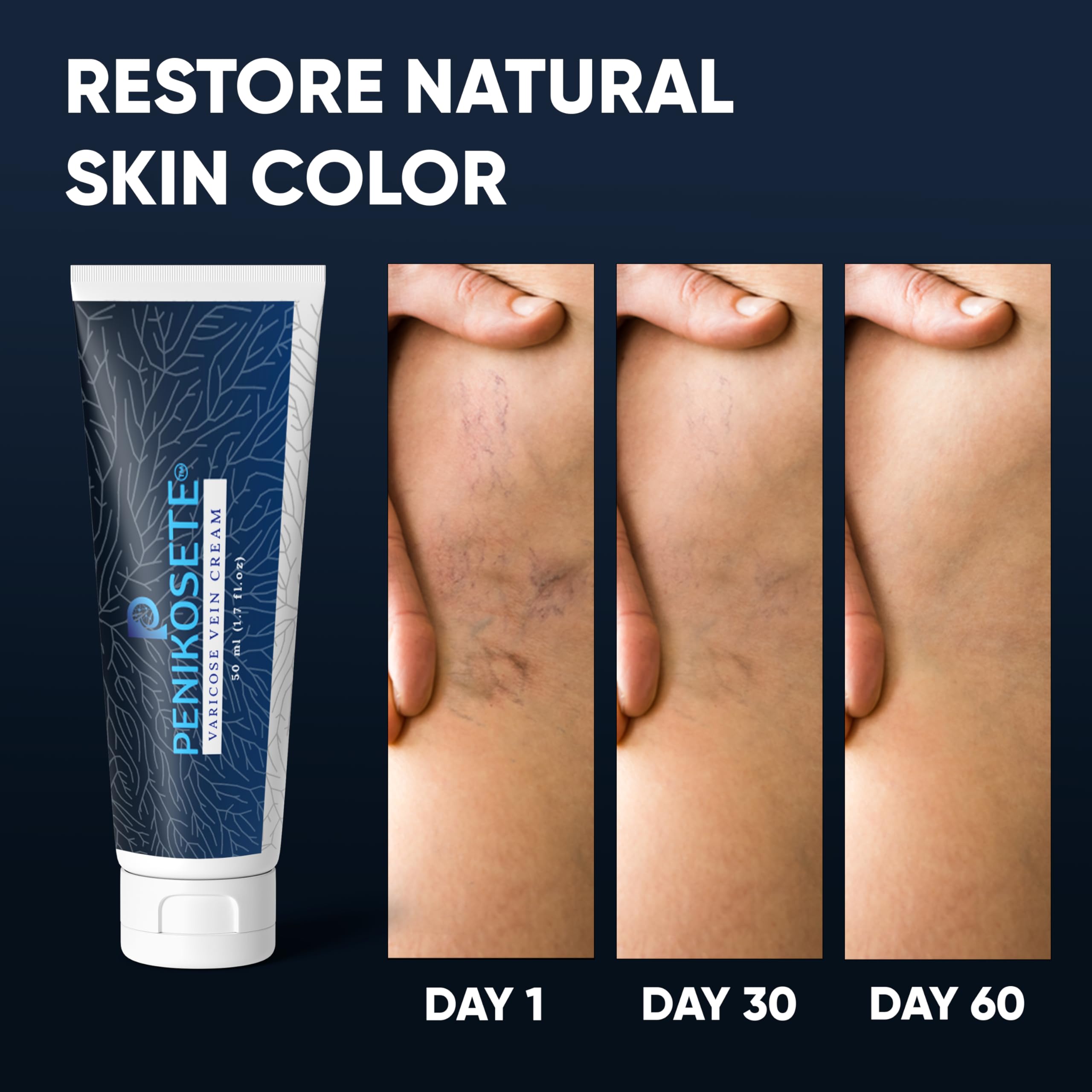 PENIKOSETE Varicose & Spider Vein Cream for Legs | Dermatologically Tested Ayurvedic Ashwagandha Formula | Natural Non-Sticky Cream for Tired, Swollen & Heavy-Looking Legs | For Men & Women - 1 Pack