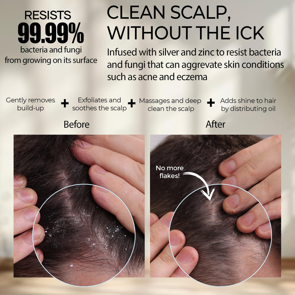 Fiora Naturals Scalp Massager Shampoo Brush - Silicon Scalp Scrubber & Exfoliator for Dandruff Removal and Hair Growth, Brush for Wet & Dry Hair, for Men, Women, Kids - BPA Free