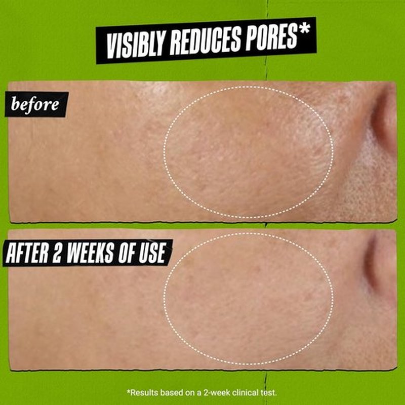 Kiehl's Rare Earth Deep Pore Cleansing Face Mask - Detox Clay Mask for Blackhead & Acne Control