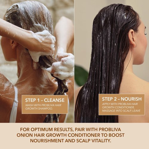 ProBliva Biotin Shampoo and Onion Conditioner Set for Thinning Hair in Adults 30+ – Strengthening Duo Reduces Shedding, Supports Fuller & Stronger Hair – Biotin + Rosemary + Onion Extracts