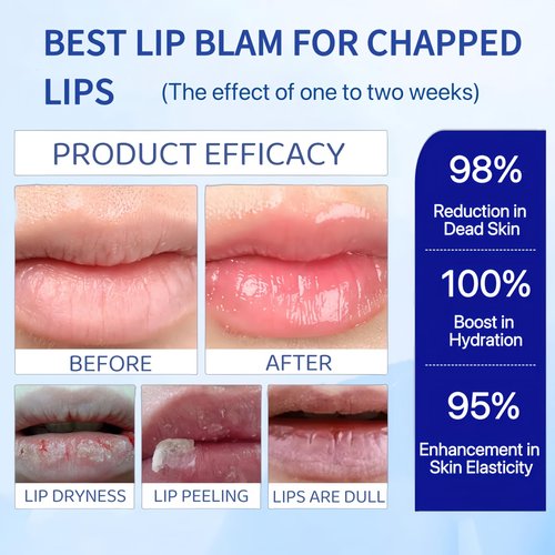 Moisturizing Repairing Lip Balm, 2-Pack,Designed for Chapped Lips, Gently Exfoliates, Deeply Hydrates and Locks in Moisture. Enriched with Shea Butter and Beeswax.