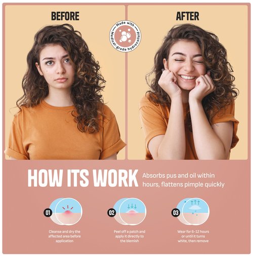GoGleefy Pimple Patches for Face – Day & Night Acne Patches for Fast Healing, Skin Clarity – Invisible Hydrocolloid Patches, Waterproof Spot Treatment – All Skin Types Zit Patches of 60/120/180