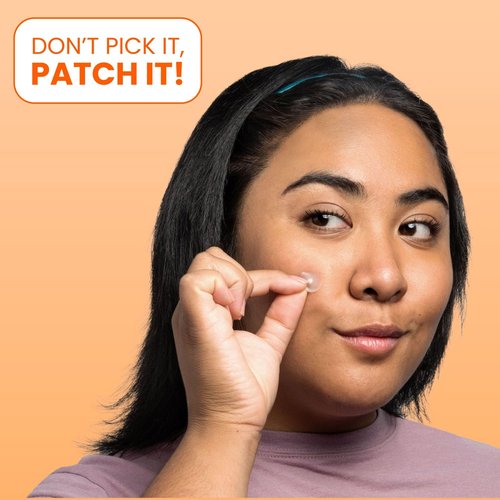 Biore Pimple Patches, Cover & Conquer Blemish Patch, Medical Grade Ultra-Thin Hydrocolloid for Covering Zits and Blemishes, HSA/FSA Approved, 30 Count