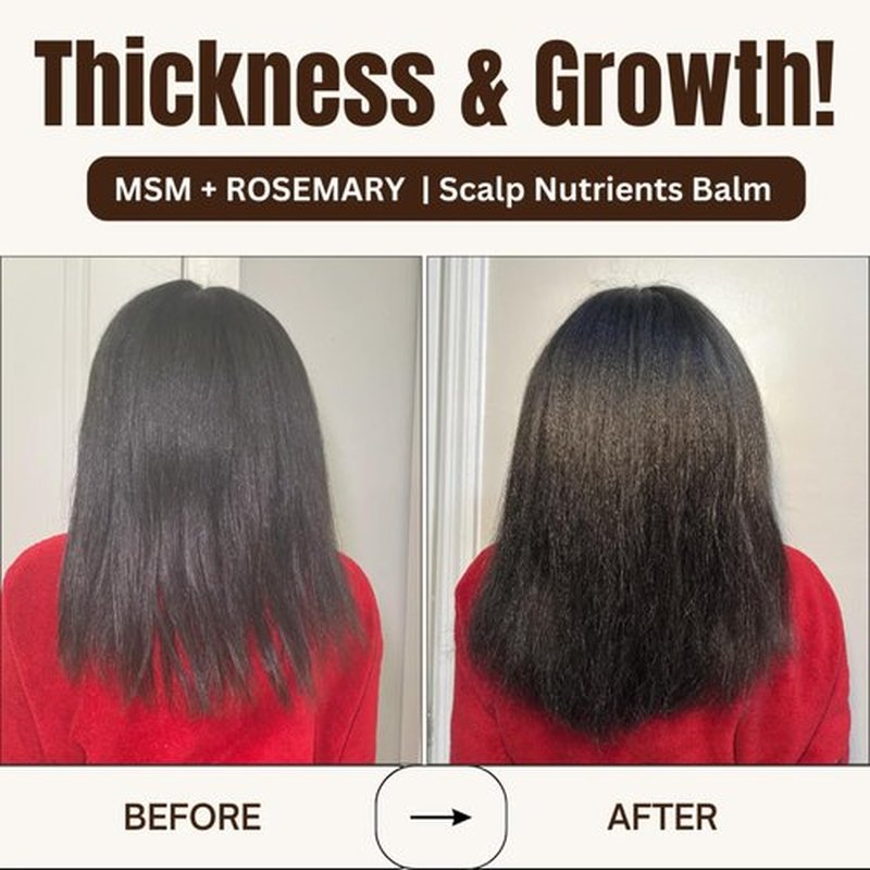 Qhemet Biologics MSM + Rosemary Scalp Nutrients Balm | Scalp Food for Hair Growth | MSM, Rosemary, Bhringraj, Castor Oil & Coconut Oil | For Dry Scalp, Thinning & Slow Growth | Vegan (4 oz)