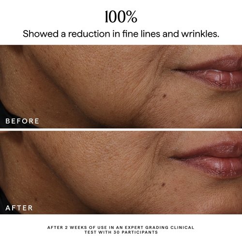 Herbivore Bakuchiol Dual-Retinol Alternative Face Serum | Smoothing & Firming for All Skin Types,1.0 ounce